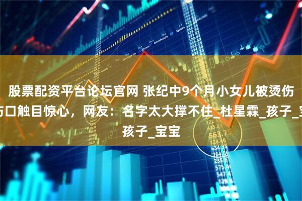 股票配资平台论坛官网 张纪中9个月小女儿被烫伤，伤口触目惊心，网友：名字太大撑不住_杜星霖_孩子_宝宝